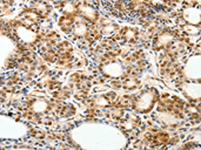 Anti-PDCD6