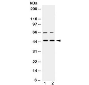 Anti-MPI / Mannose Phosphate Isomerase