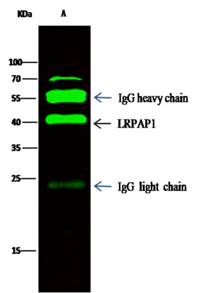 Anti-LRPAP1/A2MRAP Monoclonal Recombinant Antibody