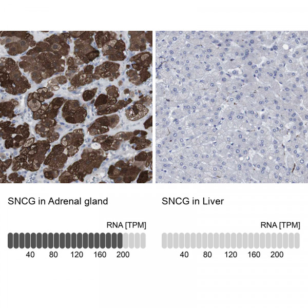 Anti-SNCG