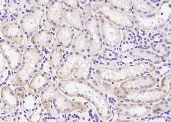 Anti-Insulin Receptor/INSR/CD220 Monoclonal Antibody