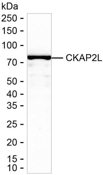 Anti-CKAP2L