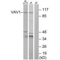 Anti-VAV1 (Ab-174)