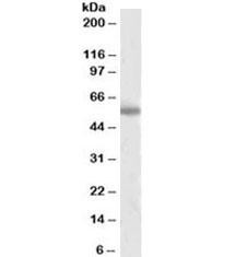 Anti-Tyrosine Hydroxylase