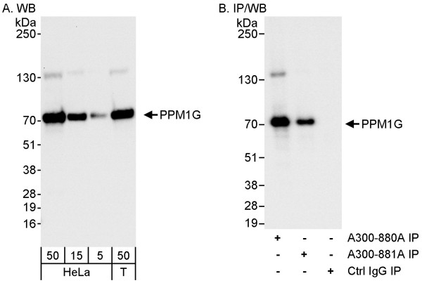 Anti-PPM1G