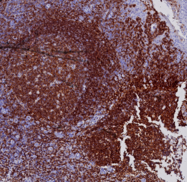 Anti-CD19 (B-Lymphocyte Marker), clone CD19/7665