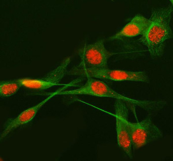 Anti-METTL17 / Methyltransferase-like protein 17