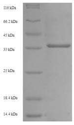 Low affinity immunoglobulin gamma Fc region receptor III (Fcgr3), partial, mouse, recombinant