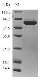 Aldo-keto reductase family 1 member B10 (AKR1B10), human, recombinant