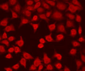 Anti-ELAVL2
