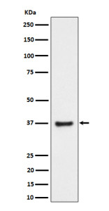 Anti-RNF115 / Ring finger protein 115, clone 30R26