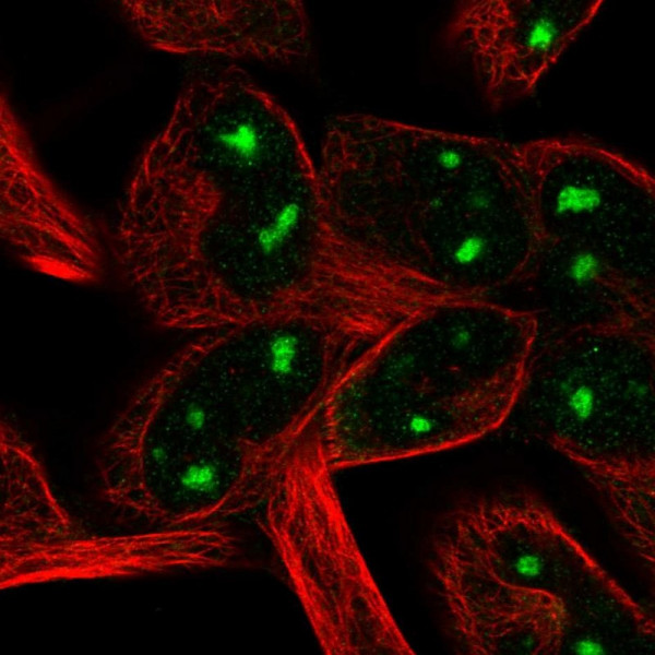 Anti-LHFP