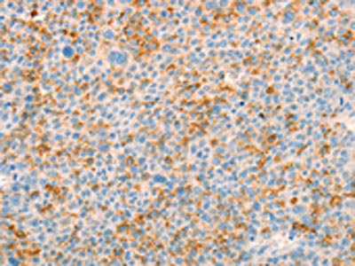Anti-TRPM7
