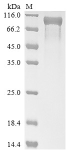 Granulocyte colony-stimulating factor receptor (CSF3R), partial, human, recombinant