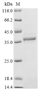 Fragile X mental retardation syndrome-related protein 1 (FXR1), partial, human, recombinant