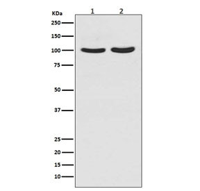 Anti-Androgen Receptor, clone HD-1