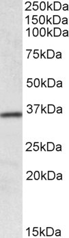 Anti-HOXA4, Internal