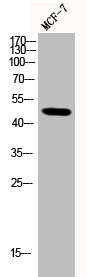 Anti-Phospho-SMAD3 (S204)