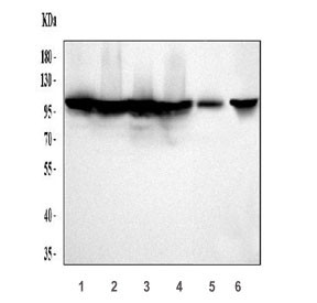 Anti-Mineralocorticoid Receptor / MR