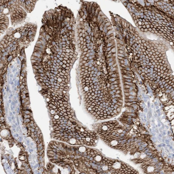 Anti-ATP11C
