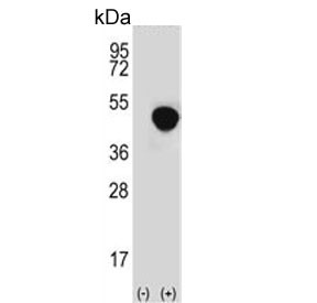 Anti-LRG1 / Leucine-rich alpha-2-glycoprotein