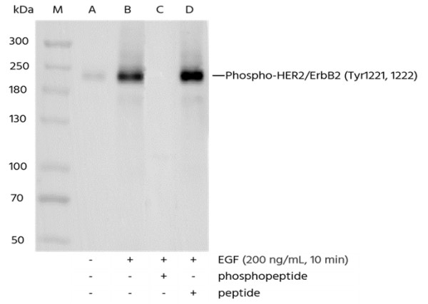 Anti-Phospho-HER2/ErbB2 (Tyr1221, 1222) Monoclonal Recombinant Antibody