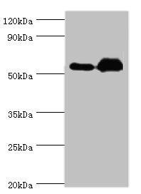 Anti-ALDH1A2