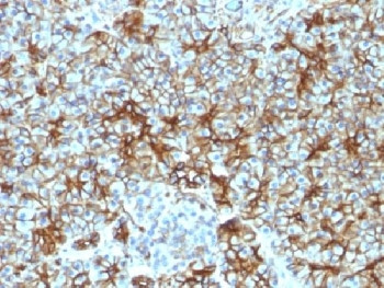 Anti-SPTBN2 / Spectrin beta III, clone SPTBN2/1583