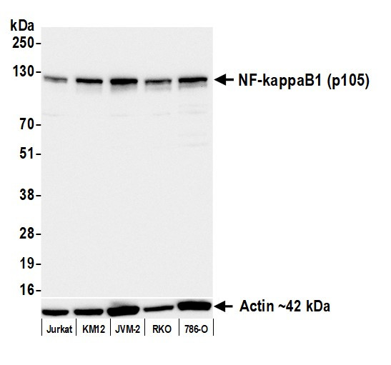 Anti-NF-kappaB1 (p105) Recombinant Monoclonal