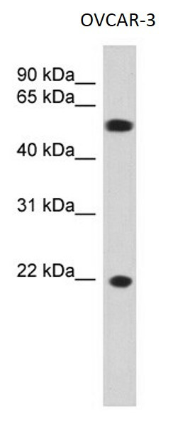 Anti-gamma Crystallin C
