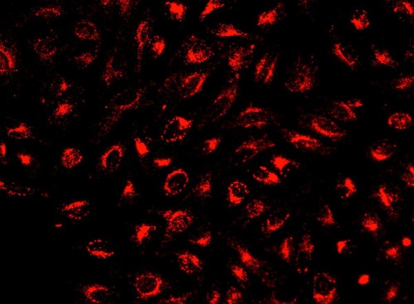 Cell Explorer(TM) Live Cell Tracking Kit *Deep Red Fluorescence*