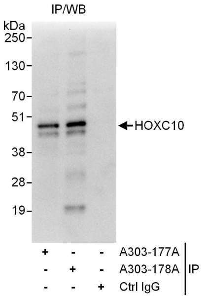 Anti-HOXC10