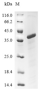 Low-density lipoprotein receptor-related protein 1 (LRP1), partial, chicken, recombinant