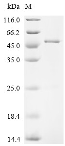 Peroxisome proliferator-activated receptor delta (PPARD), partial, human, recombinant