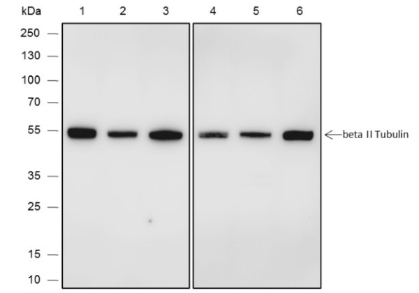 Anti-Recombinant beta II Tubulin, clone A592