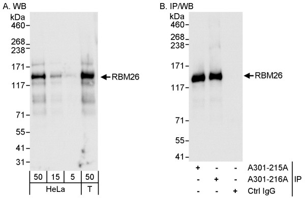 Anti-RBM26