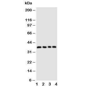 Anti-CD1d