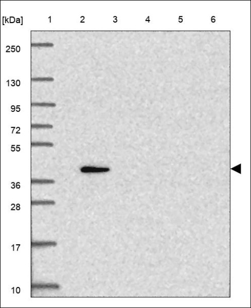 Anti-CDK14