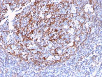 Anti-CD21 (Mature B-Cell &amp; Follicular Dendritic Cell Marker) Monoclonal Antibody (Clone: CR2/3124R)
