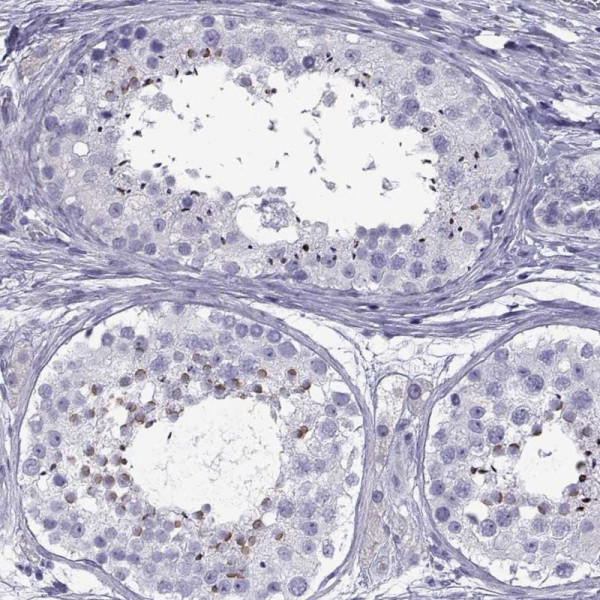Anti-SPDYE1