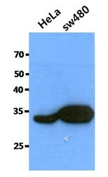 Anti-Cathepsin Z, clone 6G11