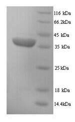 H-2 class I histocompatibility antigen, D-D alpha chain (H2-D1),partial, mouse, recombinant