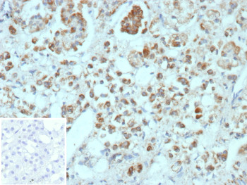 Anti-CXCR5 / BLR1, clone CXCR5/13098