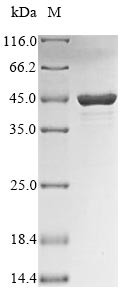 Nucleoprotein (NP), partial, Influenza B virus, recombinant