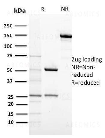 Anti-CD117 / c-Kit (Marker for Gastrointestinal Stromal Tumors) Monoclonal Antibody (Clone: KIT/2674