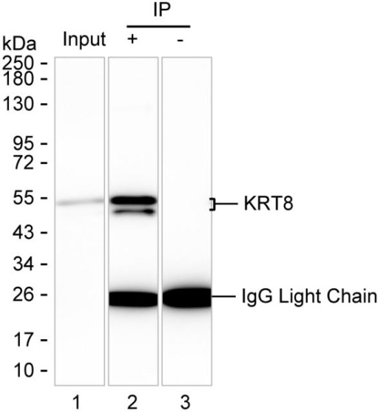 Anti-KRT8