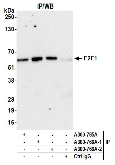Anti-E2F1