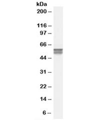Anti-CACNB4