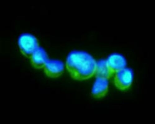 Anti-Hexokinase 1/2, clone 1A7
