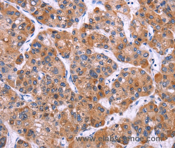 Anti-MSMO1